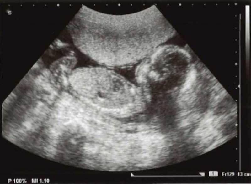 妊娠18週の赤ちゃん
